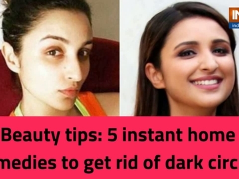 Beauty tips: 5 instant home remedies to get rid of dark circles