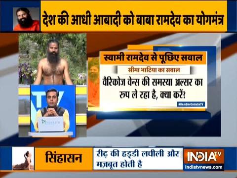 Kapalbhati, Anulom Vilom important to treat Varicose veins: Swami Ramdev