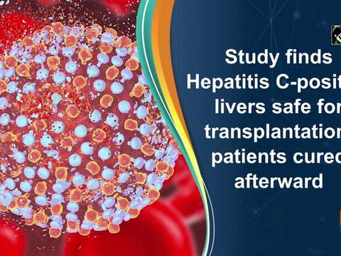 Study finds Hepatitis C-positive livers safe for transplantation, patients cured afterward