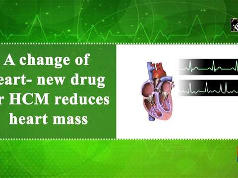 A change of heart- new drug for HCM reduces heart mass