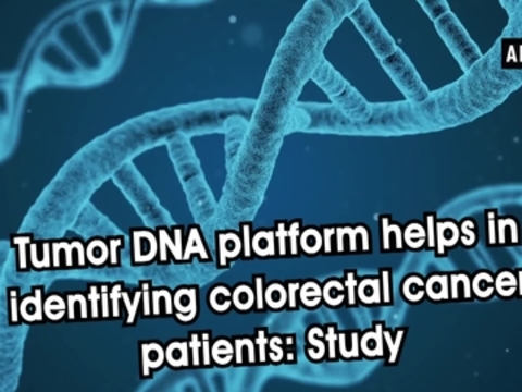 Tumor DNA platform helps in identifying colorectal cancer patients: Study