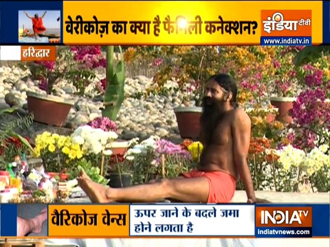 Ayurvedic remedy, diet plan by Swami Ramdev to treat varicose veins